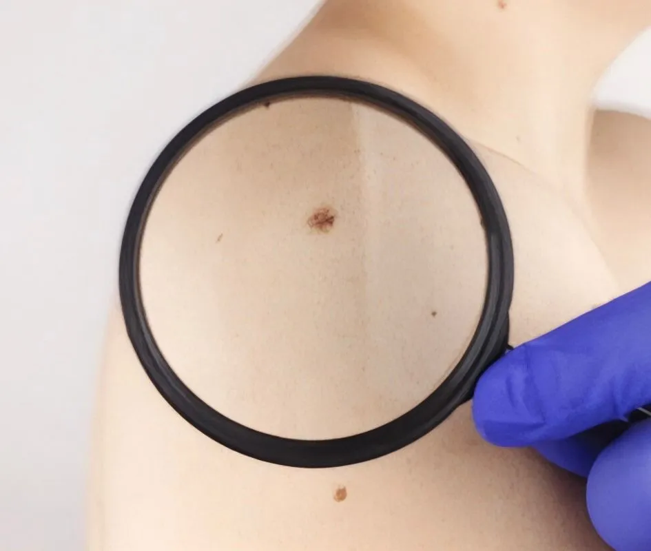 Diagnostic